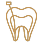 Endodoncja leczenie kanałowe